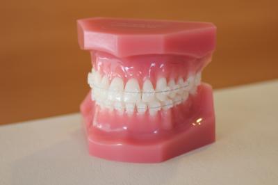 矯正歯科の目的とメリット、デメリット