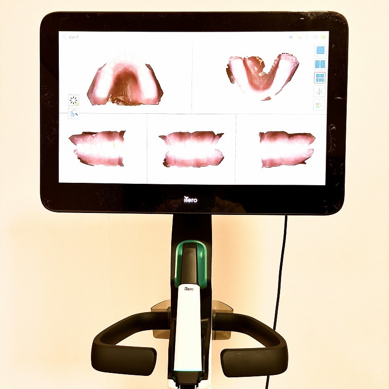 うえき矯正歯科 岡山市の矯正歯科