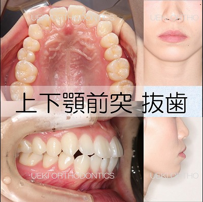 うえき矯正歯科 岡山市の矯正歯科