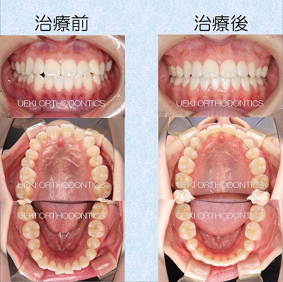 うえき矯正歯科 岡山市の矯正歯科
