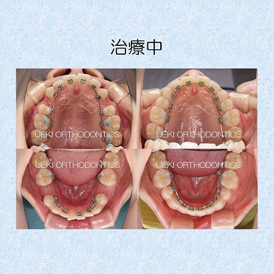 うえき矯正歯科 岡山市の矯正歯科