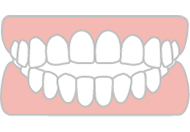 開咬（前歯でかみ切れない）