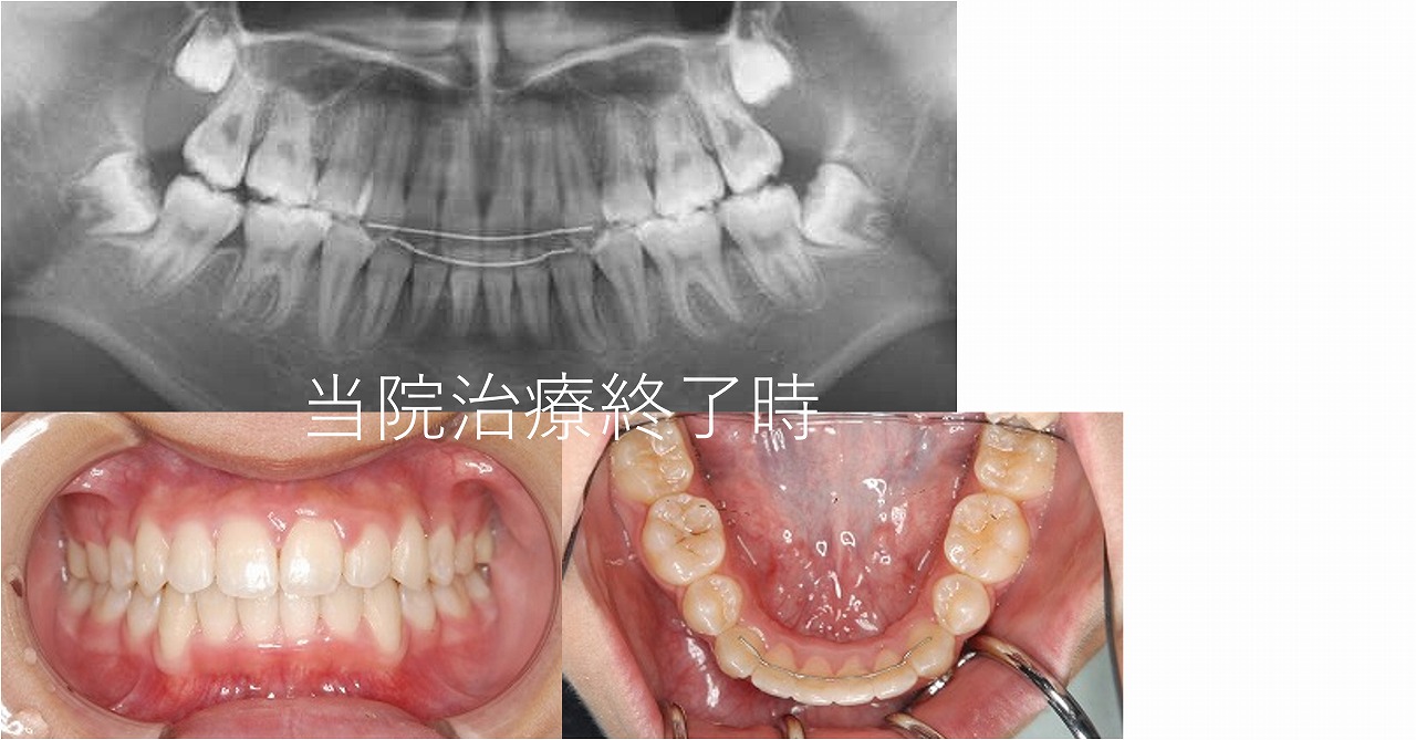 うえき矯正歯科 岡山市の矯正歯科