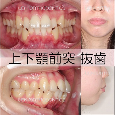 うえき矯正歯科 岡山市の矯正歯科