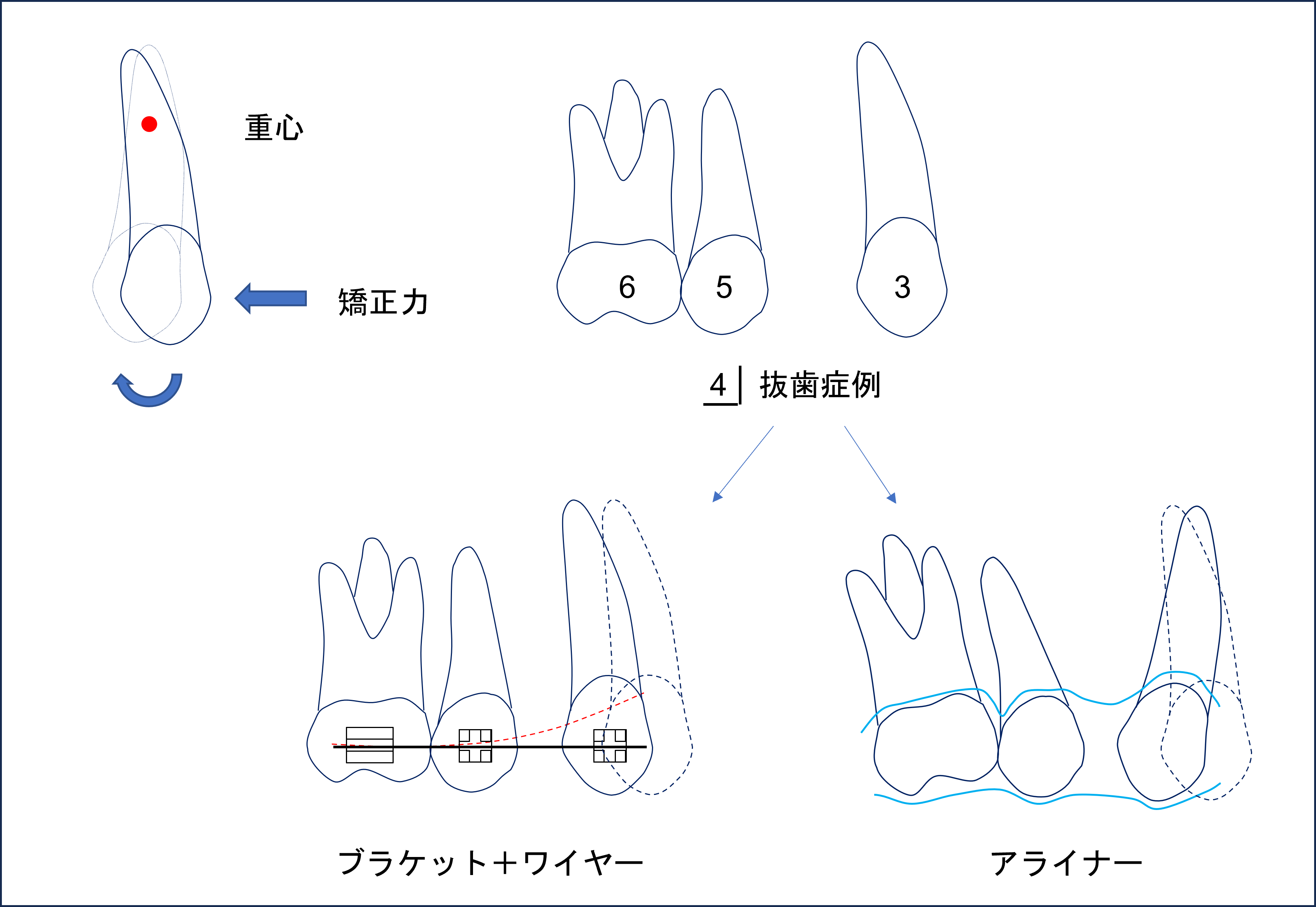 うえき矯正歯科 岡山市の矯正歯科