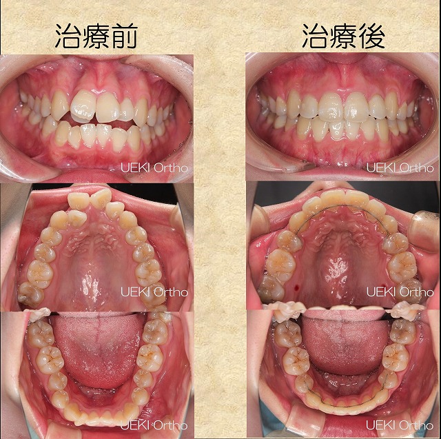 うえき矯正歯科 岡山市の矯正歯科