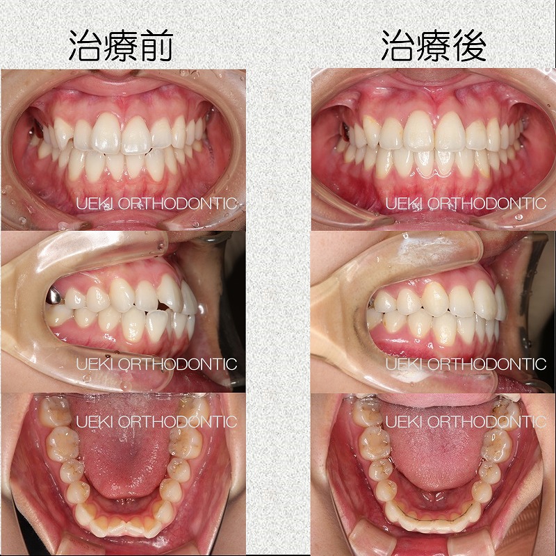 うえき矯正歯科 岡山市の矯正歯科