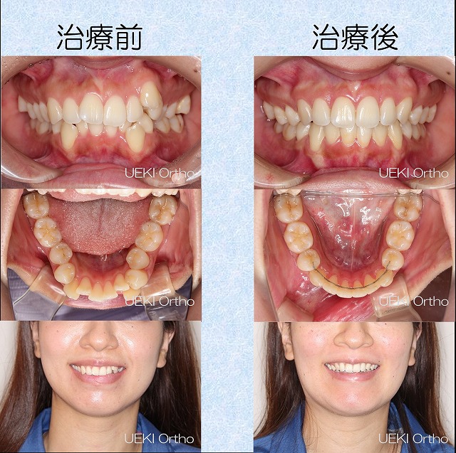 うえき矯正歯科 岡山市の矯正歯科