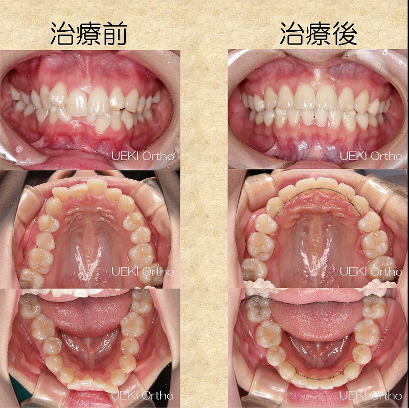 うえき矯正歯科 岡山市の矯正歯科