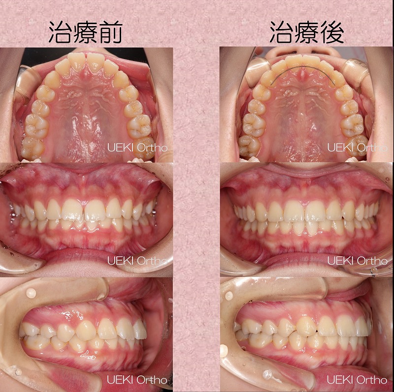 うえき矯正歯科 岡山市の矯正歯科