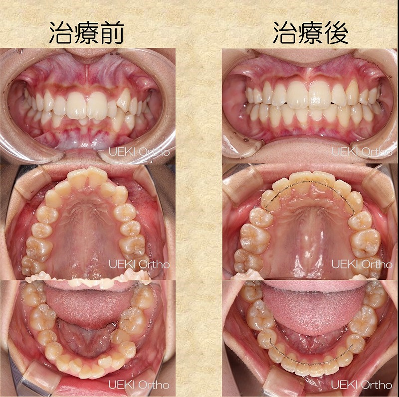 うえき矯正歯科 岡山市の矯正歯科