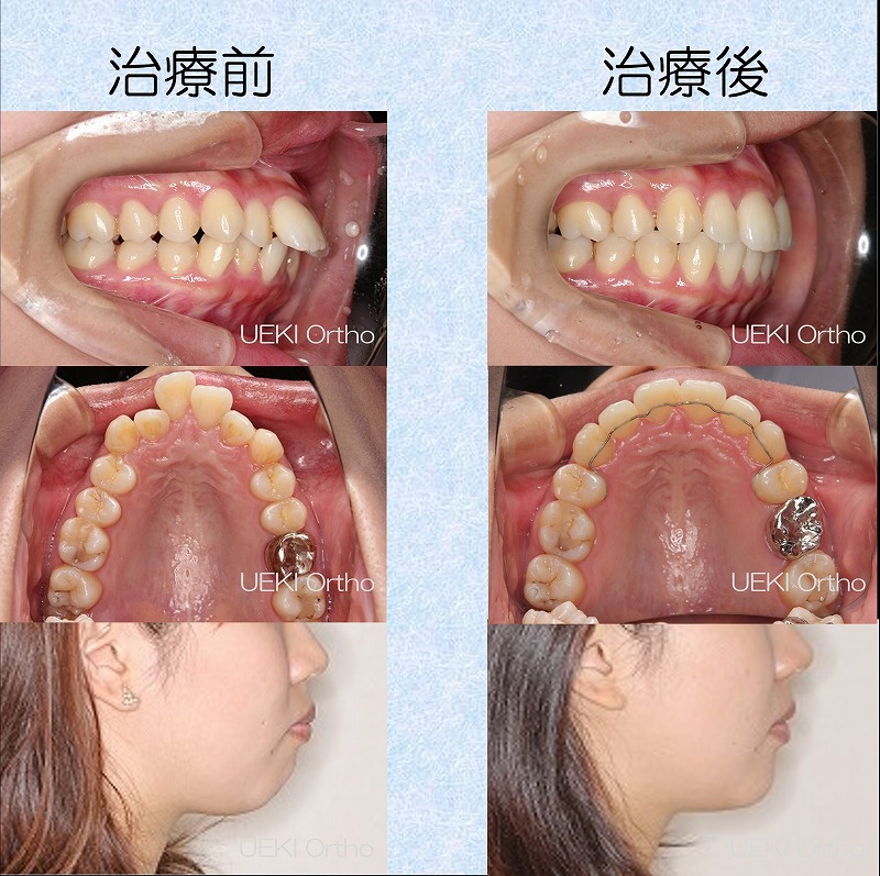 うえき矯正歯科 岡山市の矯正歯科