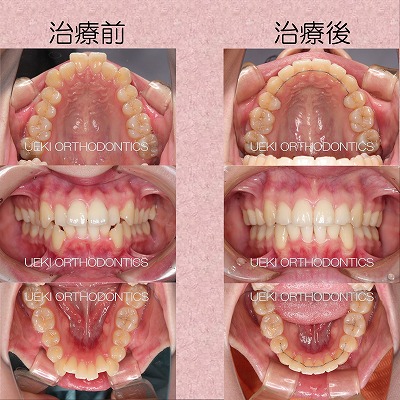 うえき矯正歯科 岡山市の矯正歯科