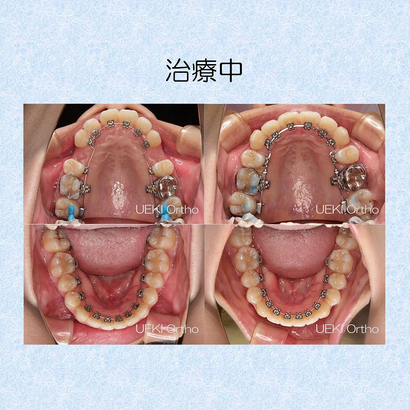 うえき矯正歯科 岡山市の矯正歯科