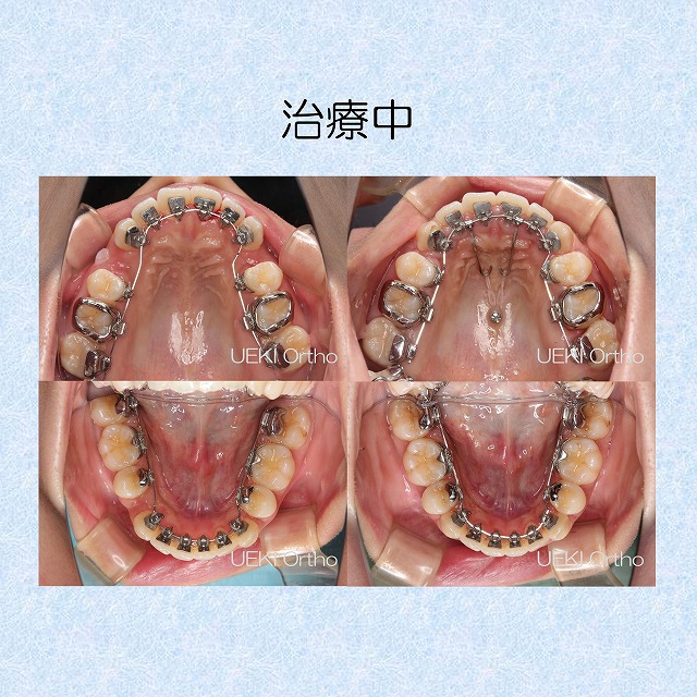 うえき矯正歯科 岡山市の矯正歯科