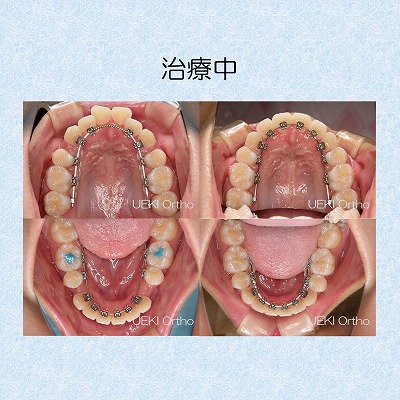 うえき矯正歯科 岡山市の矯正歯科
