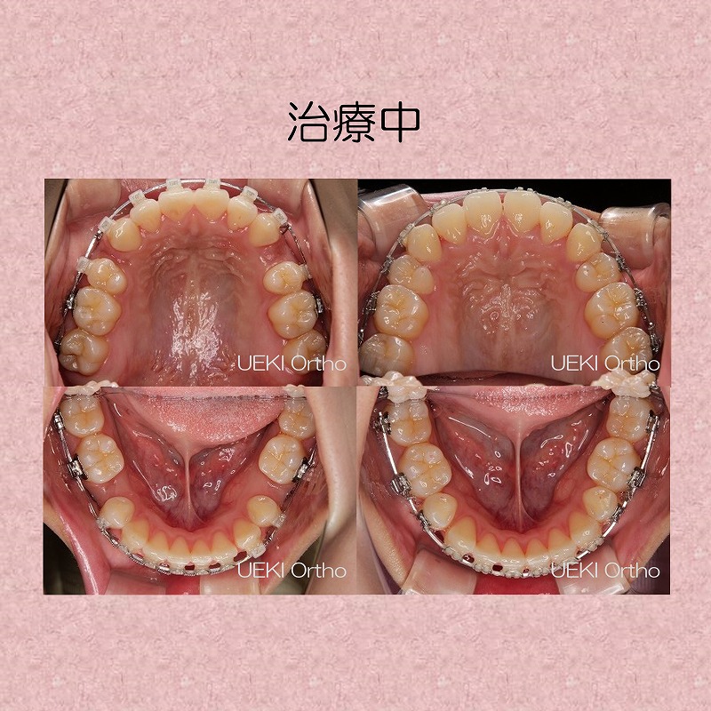 うえき矯正歯科 岡山市の矯正歯科