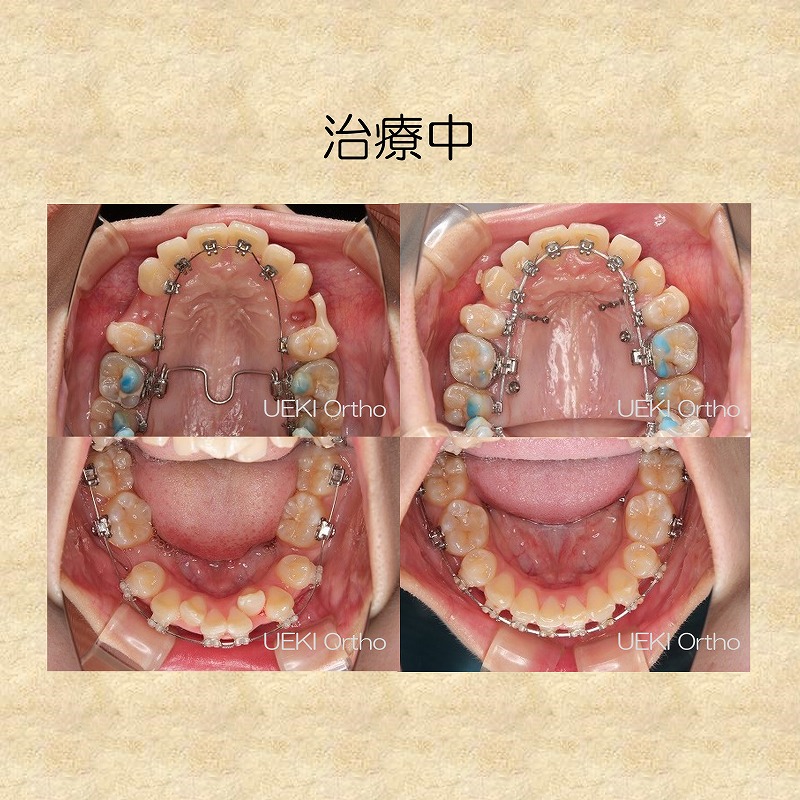 うえき矯正歯科 岡山市の矯正歯科