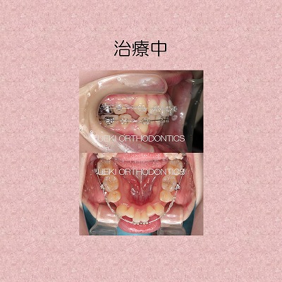 うえき矯正歯科 岡山市の矯正歯科