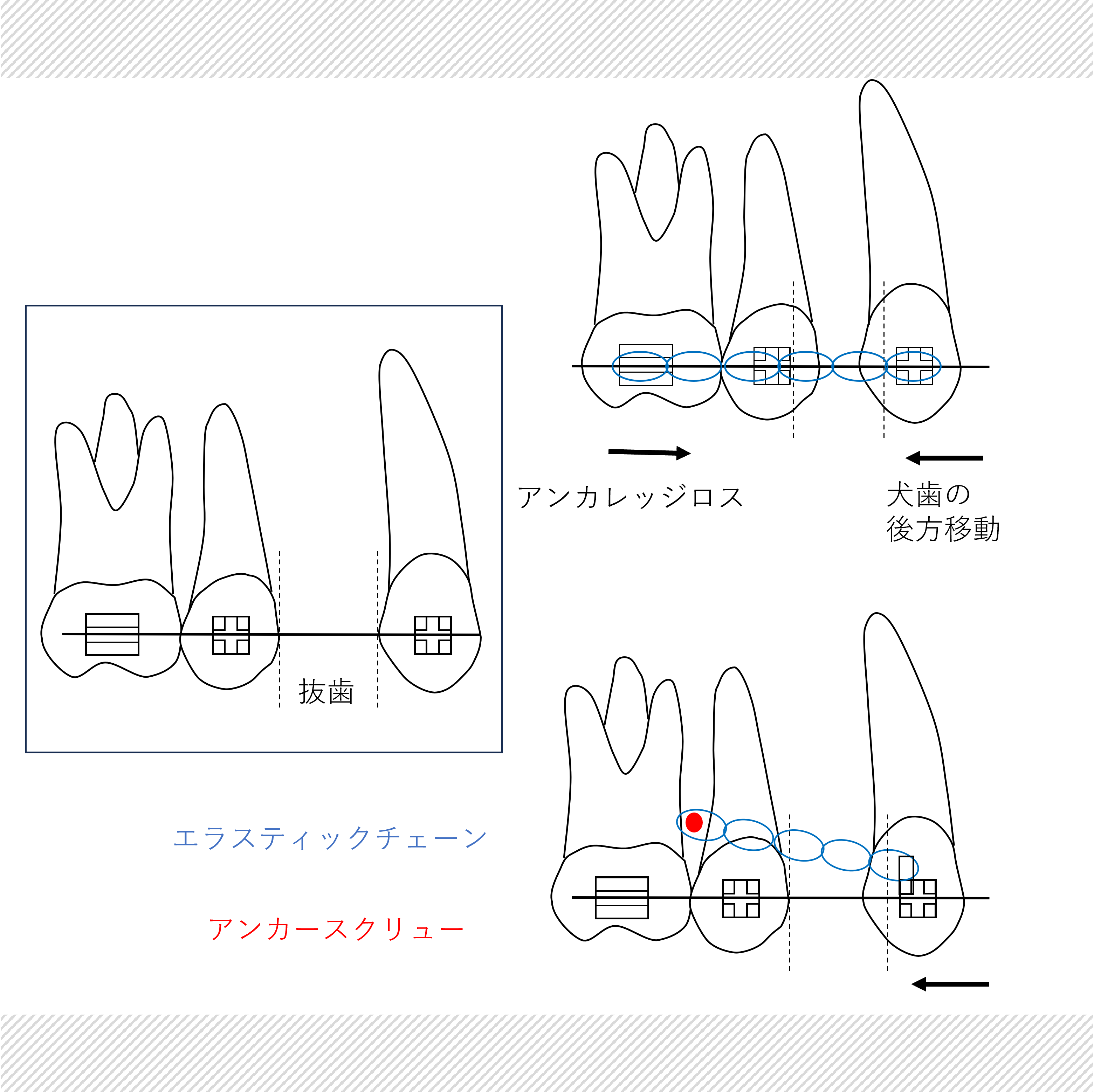 うえき矯正歯科 岡山市の矯正歯科