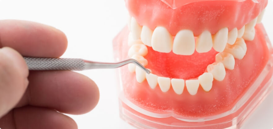 むし歯や歯周病の予防